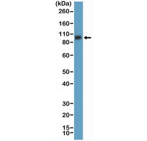Western blot testing of mouse spleen tissue lysate with recombinant CD61 antibody at 1:5000 dilution. Expected molecular weight: 87-110 kDa depending on glycosylation level.