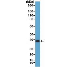 Western blot testing of human K562 cell lysate with recombinant ANXA1 antibody at 1:2000 dilution. Predicted molecular weight ~36 kDa.