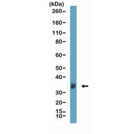 Western blot testing of human brain tissue with recombinant Clusterin antibody at 1:1000. Predicted molecular weight: 75-80 kDa (heterodimer precursor), 36-39 kDa (alpha subunit).