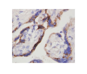 IHC-P: beta-HCG antibody testing of human placenta tissue. HIER: steamed with pH6 citrate buffer, HRP-staining.