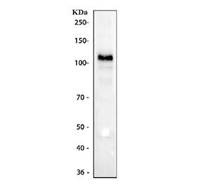 Western blot testing of human K562 cell lysate with CD30 antibody. Predicted molecular weight: 53-120 kDa depending on glycosylation level.
