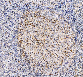 IHC staining of FFPE human tonsil tissue with PD1 antibody. HIER: boil tissue sections in pH8 EDTA for 20 min and allow to cool before testing.