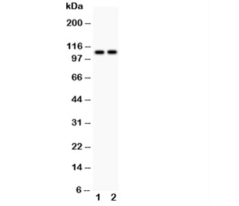 Western blot testing of ATP2A1 antibody and Lane 1:  rat skeletal muscle;  2: mouse skeletal muscle;  Predicted size: 110KD;  Observed size: 110KD