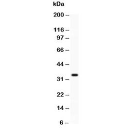 Western blot testing of HGF antibody and mouse NIH3T3 cell lysate. Predicted molecular weight: 76-91 kDa (precursor), 54-64 kDa (alpha chain), 31-34 kDa (beta chain).