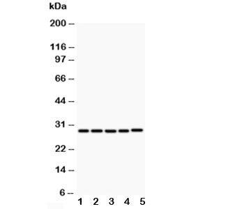 Western blot testing of CD40L antibody and Lane 1:  MCF-7;  2: HeLa;  3: Jurkat;  4: HMY2;  5: COLO320;  Expected molecular weight: 29-39 kDa (depending on glycosylation level) or ~18 kDa (soluble form).