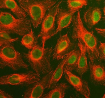 Immunofluorescent staining of FFPE human U-2 OS cells with MAPK1/3 antibody (green) and Alpha Tubulin mAb (red). HIER: steam section in pH6 citrate buffer for 20 min.