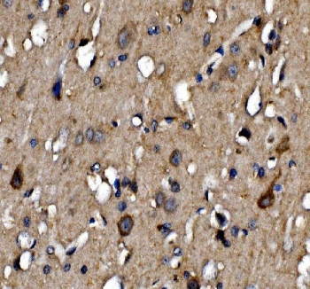 IHC staining of FFPE rat brain tissue with NMDAR2A antibody. HIER: boil tissue sections in pH8 EDTA for 20 min and allow to cool before testing.
