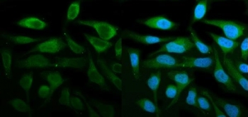 Immunofluorescent staining of FFPE human HeLa cells with STAT1 antibody (green) and DAPI nuclear stain (blue). HIER: steam section in pH6 citrate buffer for 20 min.