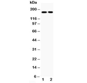 Western blot testing of Topoisomerase II alpha antibody and human 1: HeLa; 2: Jurkat cell lysate;  Predicted molecular weight ~174 kDa.