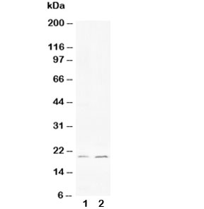 Western blot testing of 1) human HeLa and 2) rat PC-12 cell lysate with Bcl-XS antibody. Predicted/observed molecular weight: ~19 kDa.