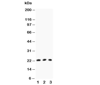 Western blot testing of TNFb antibody and Lane 1:  HeLa;  2: MCF-7;  3: COLO320