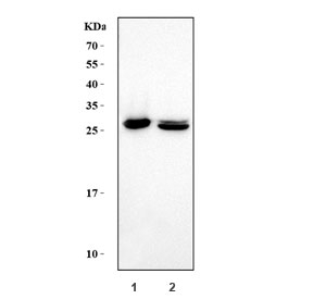 Western blot testing of 1) human HEL and 2) rat spleen tissue lysate with Carbonic Anhydrase I antibody. Predicted molecular weight ~29 kDa.