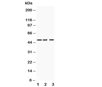 Western blot testing of ANGPTL4 antibody and Lane 1:  human placenta;  2: SMMC-7721;  3: HeLa lysate.  Predicted molecular weight: ~45 kDa and ~41 kDa, but may be observed at higher molecular weights due to glycosylation.