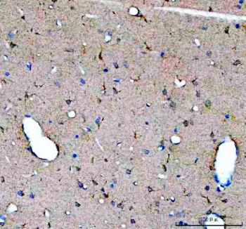 IHC staining of FFPE rat brain tissue with GDNF antibody. HIER: boil tissue sections in pH8 EDTA for 20 min and allow to cool before testing.