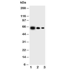 Western blot testing of IL-23 antibody and Lane 1:  recombinant mouse protein 10ng;  2: 5ng;  3: 2.5ng (p40 + p19)