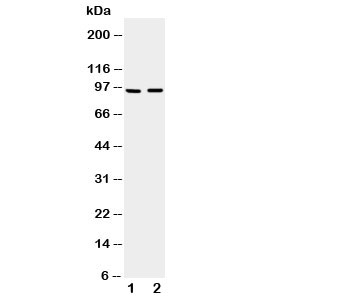 Western blot testing of ADAMTS4 antibody and Lane 1:  rat brain;  2: mouse brain tissue lysate