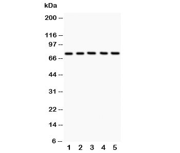Western blot testing of 12 Lipoxygenase antibody and Lane 1:  A549;  2: MCF-7;  3: COLO320;  4: Jurkat;  5: HeLa;  Predicted size: 75KD;  Observed size: 75KD
