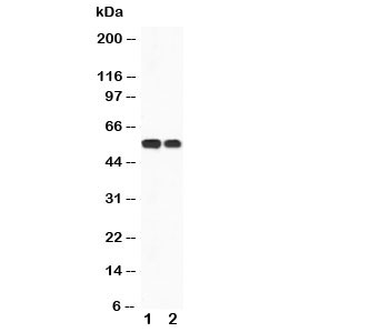 Western blot testing of CaMKK antibody and Lane 1:  rat brain;  2: mouse brain