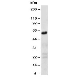 Western blot testing of CD147 antibody and human fibroma cell lysate.  Predicted molecular weight: ~27 kDa (unmodified), 43-66 kDa (glycosylated).