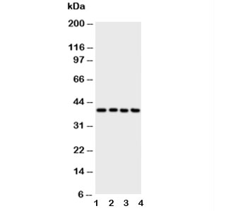 Western blot testing of ATF4 antibody and Lane 1:  A431;  2: Raji;  3: CEM;  4: HUT cell lysate. Predicted molecular weight ~39kDa.