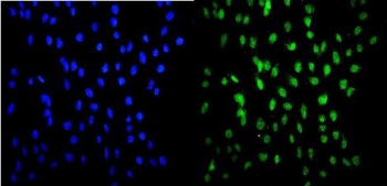 Immunofluorescent staining of FFPE human U-2 OS cells with HSF2 antibody (green) and DAPI nuclear stain (blue). HIER: steam section in pH6 citrate buffer for 20 min.