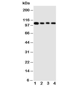 Western blot testing of HSP105 antibody and Lane 1:  rat ovary ;  2: A549 cell  lysate;  3: U87 cell  lysate;  4: HeLa cell  lysate. Expected molecular weight: 105-110 kDa.