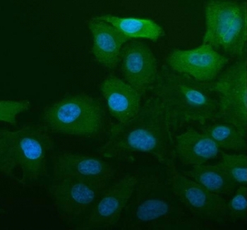 Immunofluorescent staining of FFPE human A549 cells with ALDH1A1 antibody (blue) and DAPI nuclear stain (blue). HIER: steam section in pH6 citrate buffer for 20 min.