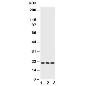 Western blot testing of FGF21 antibody and Lane 1:  human A549;  2: human A431;  3: mouse HEPA cell lysate. Predicted molecular weight ~21 kDa.