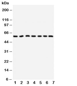 Western blot testing of CYP11B1 antibody and Lane 1:  HeLa;  2: U87;  3: MM231;  4: PANC;  5: MM453;  6: HeLa;  7: SMMC-7721 cell lysate.  Predicted size: 58KD