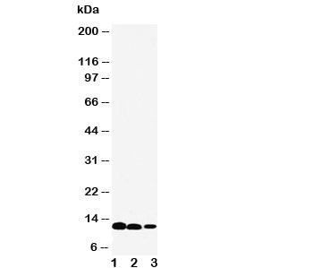 Western blot testing of IL-13 antibody and Lane 1:  recombinant human protein 10ng;  2: 5ng;  3: 2.5ng