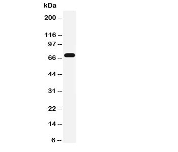 Western blot testing of Serotonin transporter antibody and rat brain tissue lysate. Expected molecular weight: ~70/85-95kDa (unmodified/glycosylated).