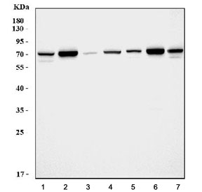 Western blot testing of 1) rat brain, 2) rat kidney, 3) rat spleen, 4) rat liver, 5) mouse brain, 6) mouse kidney and 7) mouse liver tissue lysate with SDHA antibody.  Predicted molecular weight: 57-73 kDa (multiple isoforms).