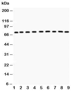 Western blot testing of GHR antibody and Lane 1:  rat liver;  2: (r) kidney;  3: (r) spleen;  4: (r) intestine;  5: mouse spleen;  6: (m) testis;  7: (m) liver;  8: (m) kidney;  9: (m) intestine. Predicted molecular weight ~72 kDa but GHR can be glycosylated, ubiquitinated and complex with GH causing a larger than predicted size to be observed.
