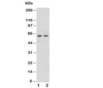 Western blot testing of NOX1 antibody and Lane 1:  human HeLa;  2: human MCF-7 cell lysate.