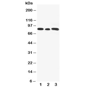 Western blot testing of Gli3 antibody and Lane 1:  rat testis;  2: human A549;  3: (h) SW620 cell lysate