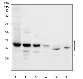 Western blot testing of 1) human 293T, 2) human Jurkat, 3) human U-251, 4) human A549, 5) rat spleen and 6) mouse spleen tissue lysate with Aurora B antibody. Predicted molecular weight: 39-45 kDa.