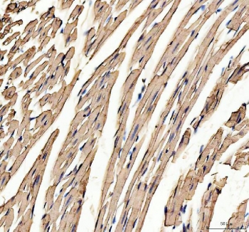 IHC staining of FFPE mouse heart tissue with Myoglobin antibody. HIER: boil tissue sections in pH8 EDTA for 20 min and allow to cool before testing.