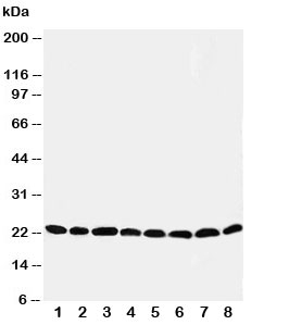 Western blot testing of Peroxiredoxin 5 antibody and Lane 1:  rat brain;  2: (r) lung;  3: (r) liver;  4: (r) kidney;  5: human HeLa;  6: (h) 293T;  7: (h) MCF-7;  8: (h) A549 cell lysate.  Expected size: ~22KD