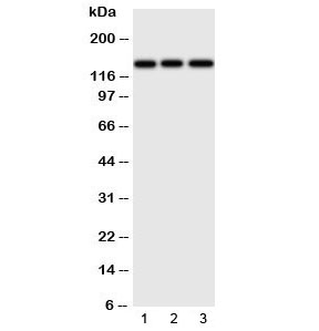 Western blot testing of ERBB4 antibody and Lane 1:  human HeLa;  2: (h) U87;  3: mouse Neuro-2a cell lysate.  Predicted molecular weight: 147-180kDa (precursor), 120, 80 kDa (cleaved forms). Observed here at ~147kDa.