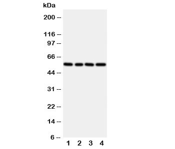 Western blot testing of TXNRD2 antibody and rat samples 1: kidney;  2: ovary;  3: liver;  4: human SMMC-7721 cell lysate