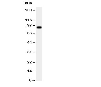 Western blot testing of CSF3R antibody and human placenta tissue lysate