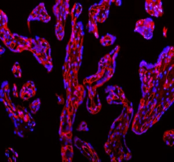 Immunofluorescent staining of FFPE human placental tissue with CD31 antibody (green) and DAPI nuclear stain (blue). HIER: steam section in pH8 EDTA buffer for 20 min.