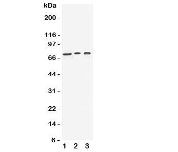 Western blot testing of VGF antibody and Lane 1: human U87;  2: (h) SHG-44;  3: mouse Neuro-2a cell lysate.  Expected molecular weight: ~90/70kDa (unprocessed/processed).