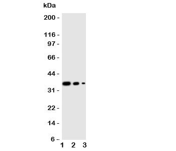 Western blot testing of WNT2B antibody and human recombinant protein, 36KD with tag;  Lane 1: 10ng;  2. 5ng;  3. 2.5ng