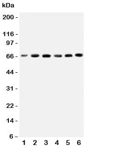 Western blot testing of CETP antbody on human cell lysates 1: HeLa;  2: COLO320;  3: HT1080;  4: Jurkat;  5: Raji;  6: MCF-7 cell lysate.  Expected molecular weight: 66~74 kDa depending on glycosylation level.