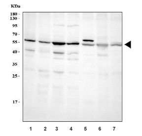 Western blot testing of 1) human 293T, 2) human HeLa, 3) human K562, 4) human SH-SY5Y, 5) rat brain, 6) rat PC-12 and 7) mouse brain tissue lysate with ABI2 antibody. Predicted molecular weight ~55 kDa.