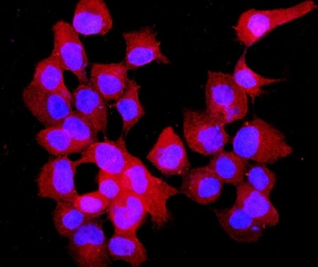 Immunofluorescent staining of FFPE human A431 cells with Annexin VII antibody (green) and DAPI nuclear stain (blue). HIER: steam section in pH6 citrate buffer for 20 min.
