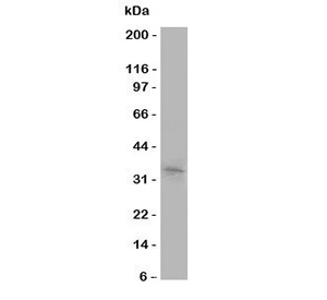 Western blot testing of Aquaporin 10 antibody and COLO320 cell lysate.