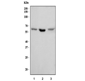 Western blot testing of 1) human U-2 OS, 2) rat PC-12 and 3) mouse NIH 3T3 cell lysate with Syndecan 3 antibody. Predicted molecular weight ~46 kDa but may be observed at higher molecular weights due to glycosylation.