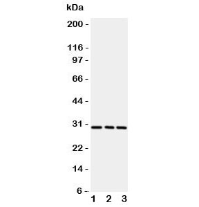 Western blot testing of CD134 / OX40 antibody and rat samples 1:  brain;  2: liver;  3: kidney.  Expected molecular weight: 29-50 kDa depending on glcyosylation level.